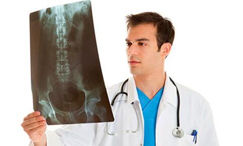 the doctor examines an x-ray to diagnose low back pain